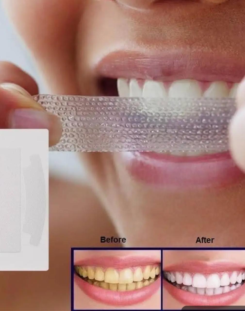 Teeth whitening strips