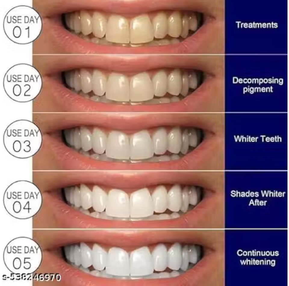 Teeth whitening strips